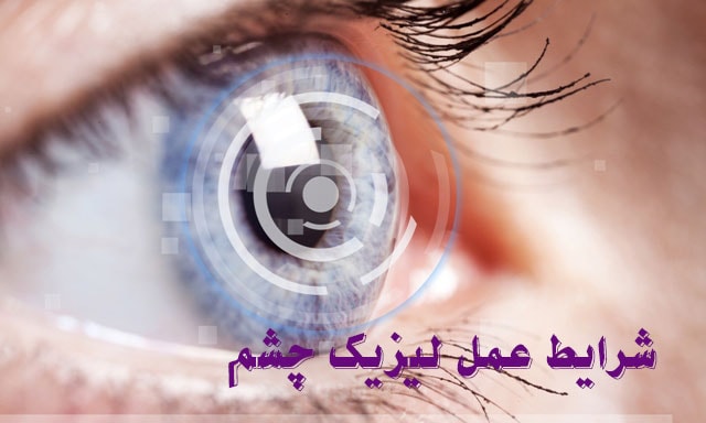 شرایط عمل لیزیک چشم