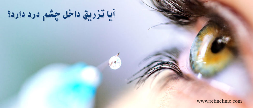 آیا تزریق داخل چشم درد دارد