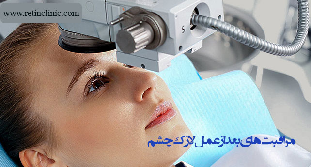 مراقبتهای بعد از عمل لازک چشم