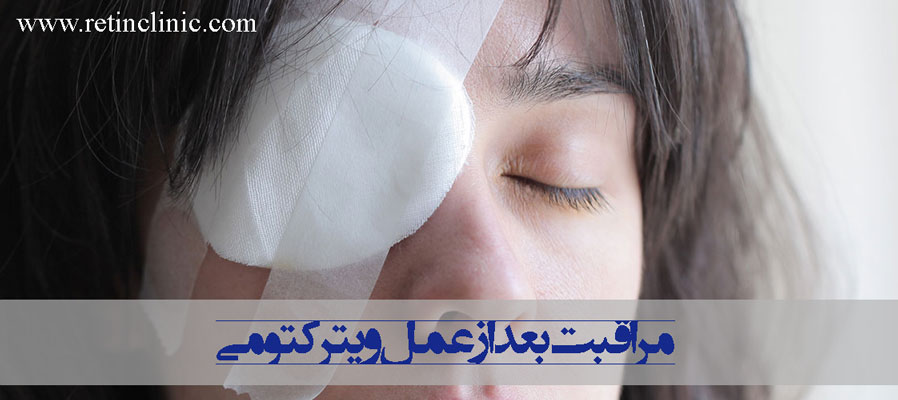 مراقبت بعد از عمل ویترکتومی