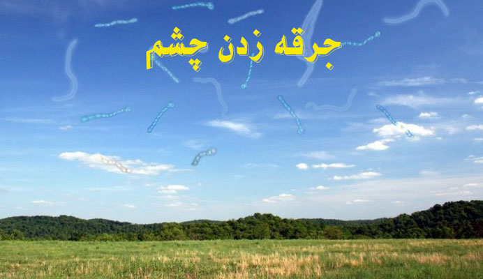 جرقه زدن چشم